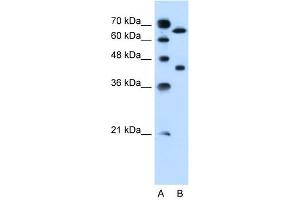 SLCO1A2 antibody used at 0. (SLCO1A2 anticorps  (Middle Region))