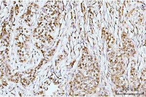 IHC analysis of IFI16 using anti-IFI16 antibody (ABIN7600374). (IFI16 anticorps  (AA 183-743))