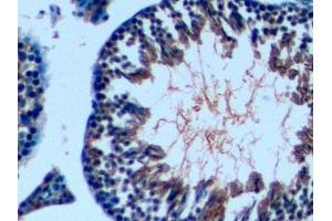 Detection of TGFb1 in Mouse Testis Tissue using Polyclonal Antibody to Transforming Growth Factor Beta 1 (TGFb1)