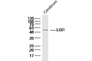 Mouse cerebrum lysates probed with LGI1 Polyclonal Antibody, unconjugated  at 1:300 overnight at 4°C followed by a conjugated secondary antibody at 1:10000 for 90 minutes at 37°C. (LGI1 anticorps  (AA 451-557))