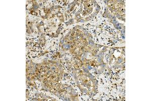 IHC analysis of Hexokinase 1/HK1 using anti-Hexokinase 1/HK1 antibody (ABIN7600258). (Hexokinase 1 anticorps  (AA 17-323))