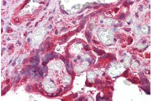 Anti-CDK6 antibody IHC staining of human placenta.