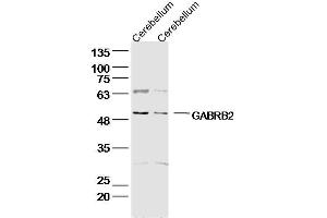 Lane 1: Rat Cerebellum lysates; Lane 2: Mouse Cerebellum lysates; probed with GABRB2/GABA A Receptor beta 2 Polyclonal Antibody, unconjugated (bs-12065R) at 1:300 overnight at 4°C followed by a conjugated secondary antibody for 60 minutes at 37°C. (GABRB2 anticorps  (AA 251-350))