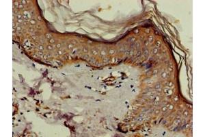 Immunohistochemistry of paraffin-embedded human skin tissue using ABIN7152180 at dilution of 1:100