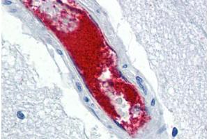 Human Brain, Cortex, Vessel (formalin-fixed, paraffin-embedded) stained with VWF antibody ABIN337312 at 5 ug/ml followed by biotinylated anti-goat IgG secondary antibody ABIN481715, alkaline phosphatase-streptavidin and chromogen. (VWF anticorps)