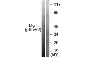 Western blot analysis of extracts from 293 cells treated with Forskolin 40nM 30', using Myc (Phospho-Ser62) Antibody. (c-MYC anticorps  (pSer62))