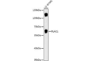 Western blot analysis of extracts of U-87MG cells, using PL antibody (ABIN7269418) at 1:1000 dilution. (PLAG1 anticorps  (AA 33-288))