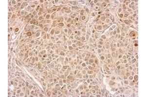 IHC-P Image CIAPIN1 antibody detects CIAPIN1 protein at cytosol on by immunohistochemical analysis. (CIAPIN1 anticorps)