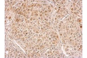 IHC-P Image CIAPIN1 antibody detects CIAPIN1 protein at cytosol on by immunohistochemical analysis. (CIAPIN1 anticorps)