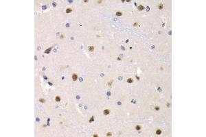 Immunohistochemistry of paraffin-embedded rat brain using IRF2 antibody (ABIN5971383) at dilution of 1/200 (40x lens).
