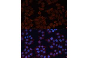 Immunofluorescence analysis of HeLa cells using  antibody (ABIN6131156, ABIN6136521, ABIN6136522 and ABIN6223942) at dilution of 1:100.