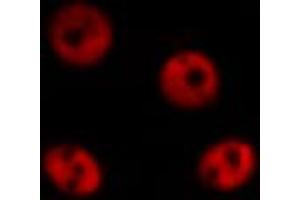 ABIN6267010 staining HepG2 by IF/ICC.