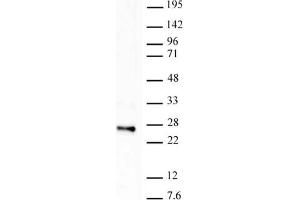 Histone H2B ubiquityl Lys120 antibody tested by Western blot. (Histone H2B anticorps  (Lys120, ubLys120))