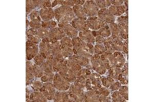 Immunohistochemical staining of human stomach with KATNB1 polyclonal antibody  shows strong cytoplasmic positivity in glandular cells at 1:1000-1:2500 dilution. (KATNB1 anticorps)
