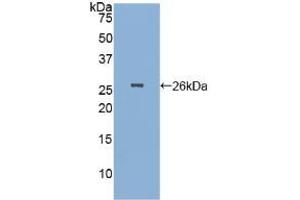 Pepsinogen A anticorps  (AA 63-295)