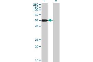 Western Blot analysis of ZNF71 expression in transfected 293T cell line by ZNF71 monoclonal antibody (M01), clone 3F4. (ZNF71 anticorps  (AA 1-100))