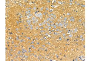 ABIN6259482 and ABIN6275755 at 1/100 staining Rat brain tissue by IHC-P. (STARD10 anticorps  (Internal Region))