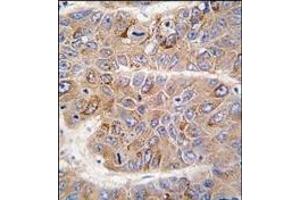 Image no. 2 for anti-Insulin Receptor Substrate 2 (IRS2) (C-Term) antibody (ABIN360098) (IRS2 anticorps  (C-Term))