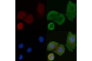 ABIN6258280 and ABIN6275235 staining Hela cells by IF/ICC. (MRPS25 anticorps  (N-Term))