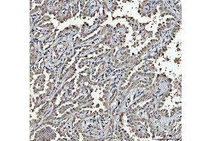 IHC analysis of RTCB using anti-RTCB antibody (ABIN7600722). (C22orf28 anticorps  (AA 227-505))