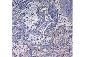 IHC analysis of Integrin alpha 5 using anti-Integrin alpha 5 antibody . (ITGA5 anticorps  (AA 42-263))