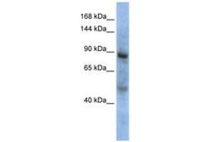 Image no. 1 for anti-Zinc Fingers and Homeoboxes 3 (ZHX3) (AA 648-697) antibody (ABIN6744227) (ZHX3 anticorps  (AA 648-697))