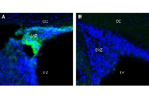 Expression of Adenosine A1 Receptor in rat subventricular zone (SVZ). (ADORA1 anticorps  (Extracellular))