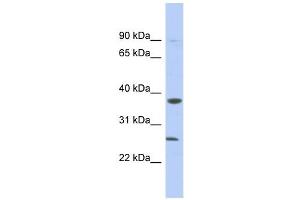 MYD88 antibody used at 1 ug/ml to detect target protein. (MYD88 anticorps)