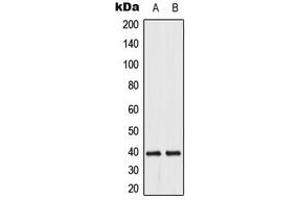 Western blot analysis of DUSP1/4 expression in HeLa (A), Jurkat (B) whole cell lysates. (MKP-1/2 anticorps  (C-Term))