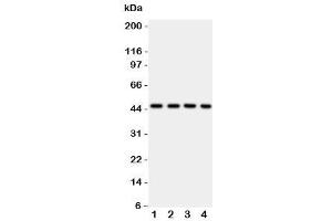 Western blot testing of PDK2 antbody on Lane 1: rat heart (PDK2 anticorps  (C-Term))