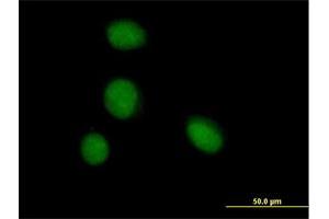 Immunofluorescence of purified MaxPab antibody to ZBTB6 on HeLa cell. (ZBTB6 anticorps  (AA 1-424))