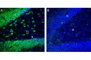 Expression of NRAMP1 in rat hippocampus.