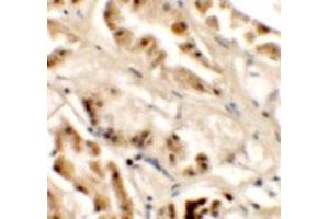 Immunohistochemical anyalysis of human kidney tissue with GZF1 polyclonal antibody  at 2. (ZNF336 anticorps  (C-Term))