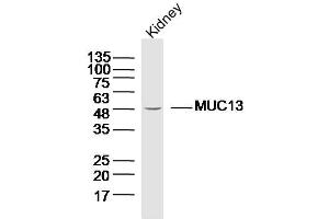 Lane 1: Mouse kidney lysates probed with Anti MUC13 Polyclonal Antibody, Unconjugated  at 1:300 overnight at 4˚C. (MUC13 anticorps  (AA 175-270))