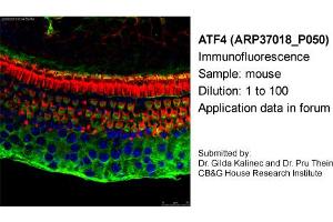 Image no. 1 for anti-Activating Transcription Factor 4 (Tax-Responsive Enhancer Element B67) (ATF4) antibody (ABIN2779919)