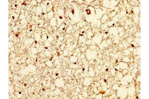 IHC image of ABIN7176635 diluted at 1:200 and staining in paraffin-embedded human brain tissue performed on a Leica BondTM system. (ZIC4 anticorps  (AA 28-88))
