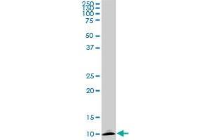 ATP6V1G2 monoclonal antibody (M02), clone 2E11.