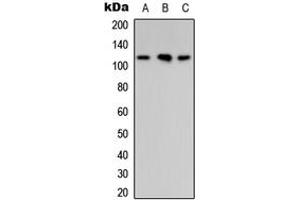 Western blot analysis of ARHGAP30 expression in MCF7 (A), Raw264. (ARHGAP30 anticorps  (Center))