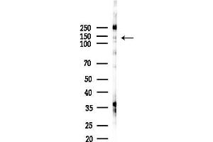 anti-Dynactin 1 (DCTN1) (C-Term) antibody