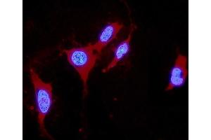 IF analysis of DDAH1 using anti-DDAH1 antibody (ABIN4886560). (DDAH1 anticorps  (C-Term))