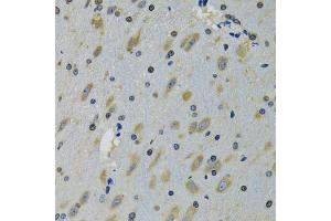 Immunohistochemistry of paraffin-embedded mouse brain using RPS12 antibody (ABIN5973491) at dilution of 1/100 (40x lens). (RPS12 anticorps)