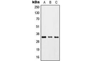 Western blot analysis of ZC3H8 expression in HepG2 (A), Raw264.