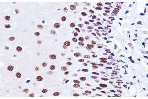 Immunohistochemistry of paraffin-embedded Human esophageal using MATR3 Polyclonal Antibody at dilution of 1:100 (40x lens). (MATR3 anticorps)