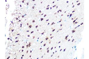 Immunohistochemistry of paraffin-embedded mouse brain using TPPP/p25 Rabbit mAb (ABIN7271031) at dilution of 1:100 (40x lens). (Tppp anticorps)