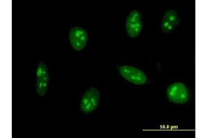 Immunofluorescence of monoclonal antibody to EXOSC5 on HeLa cell. (EXOSC5 anticorps  (AA 1-235))