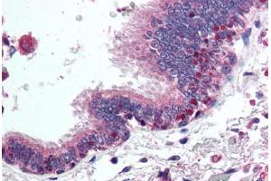 Human Lung, Respiratory Epithelium (formalin-fixed, paraffin-embedded) stained with HDAC4 antibody ABIN294416 at 5 ug/ml followed by biotinylated goat anti-rabbit IgG secondary antibody ABIN481713, alkaline phosphatase-streptavidin and chromogen. (HDAC4 anticorps  (AA 194-209))