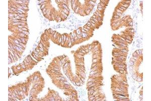 IHC-P Image CES2 antibody detects CES2 protein at cytosol on human colon by immunohistochemical analysis. (CES2 anticorps)