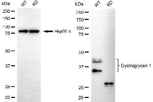 Western blotting analysis using dystroglycan 1 antibody (ABIN7798412). (Recombinant Dystroglycan anticorps)