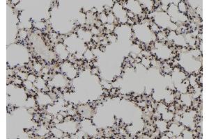 ABIN6267181 at 1/100 staining Mouse lung tissue by IHC-P. (SKP2 anticorps  (pSer64))
