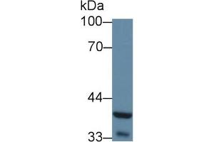 Detection of WNT5A in Mouse Liver lysate using Polyclonal Antibody to Wingless Type MMTV Integration Site Family, Member 5A (WNT5A)